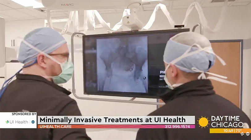 Minimally Invasive Procedures for Stroke Care